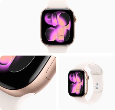 Apple Watch Series 11 Nhôm (GPS + LTE)